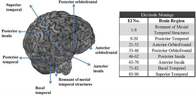 Predictability and Resetting in a Case of Convulsive Status Epilepticus